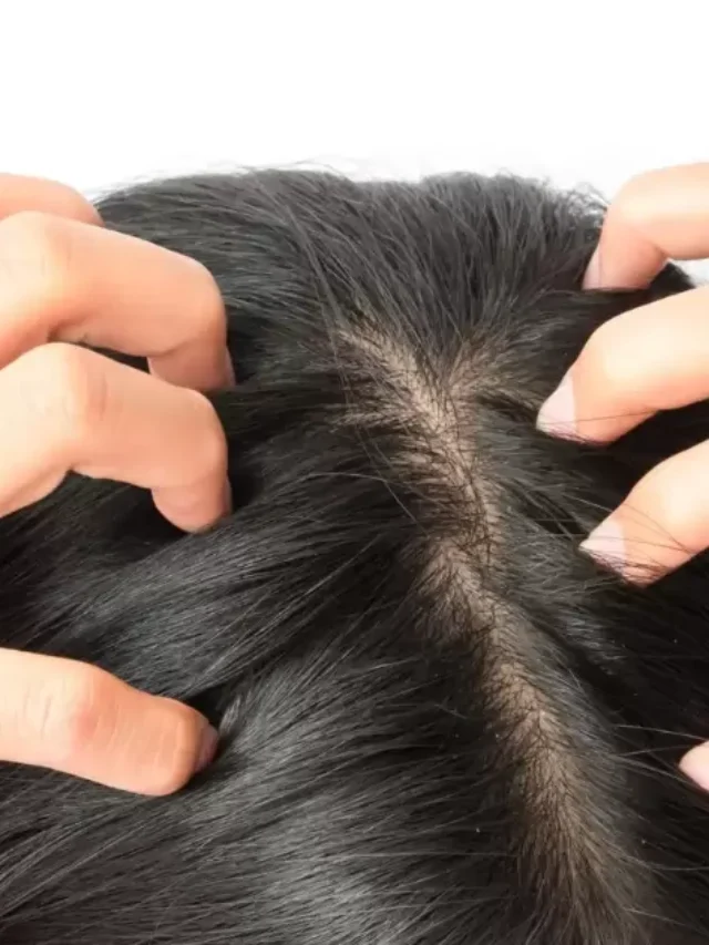 How To Care For Oily Hair And Scalp?