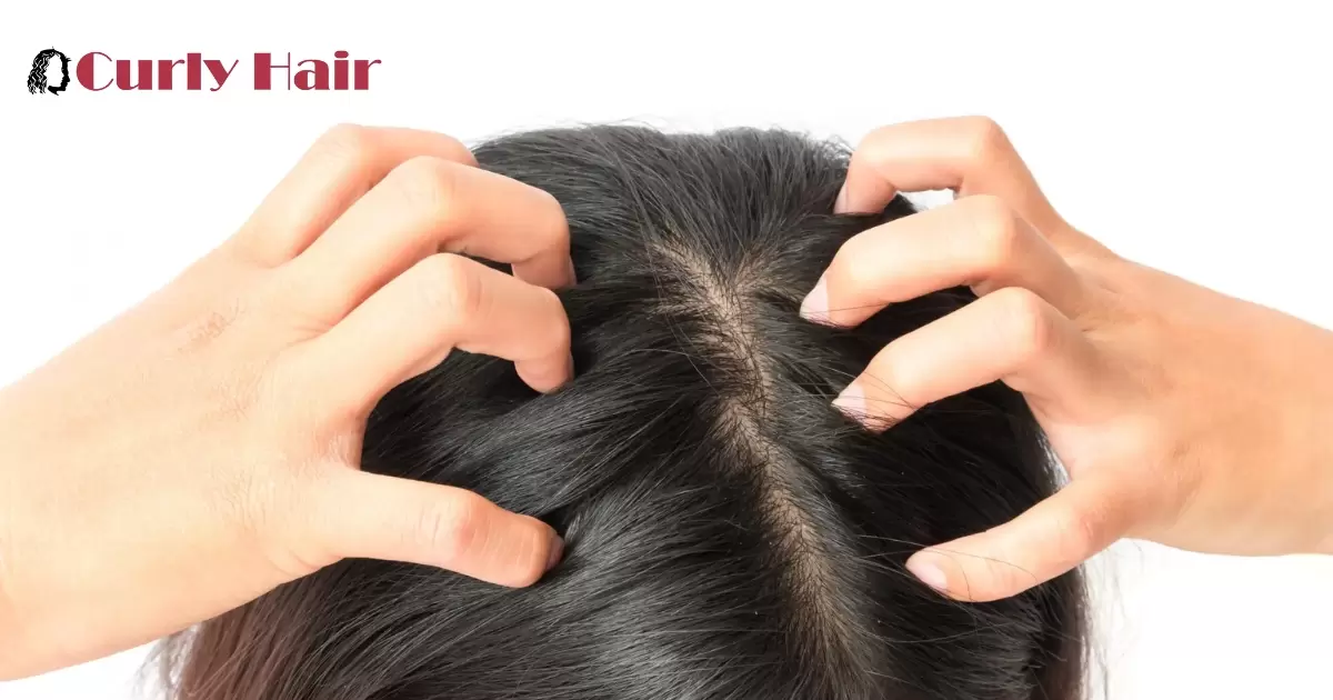 How To Care For Oily Hair And Scalp?