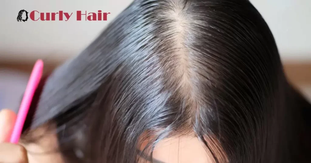 How To Treat Oily Scalp And Thinning Hair?