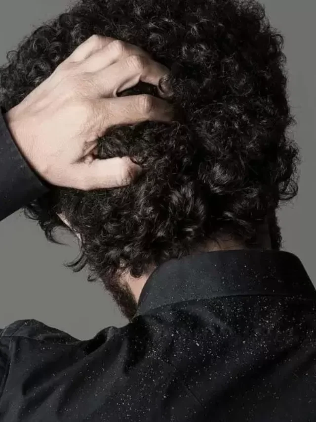 What Causes Dandruff In Curly Hair?