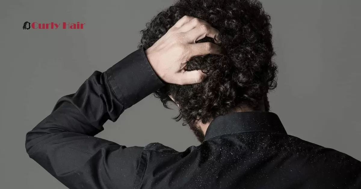 What Causes Dandruff In Curly Hair?