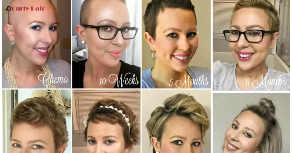 A Guide To Growing Your Hair After Chemo