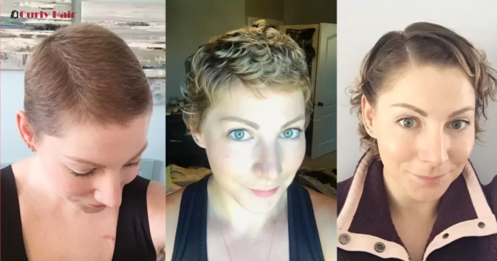 When Does Hair Grow Back After Chemo?